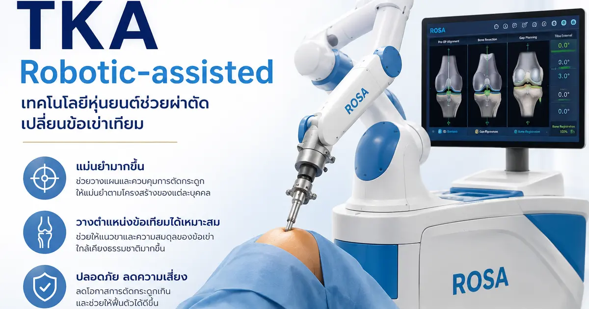 ข้อดีของการผ่าตัดเปลี่ยนข้อเข่าโดยใช้TKA Robotic-assisted ที่คนไข้ข้อเข่าเสื่อมควรรู้