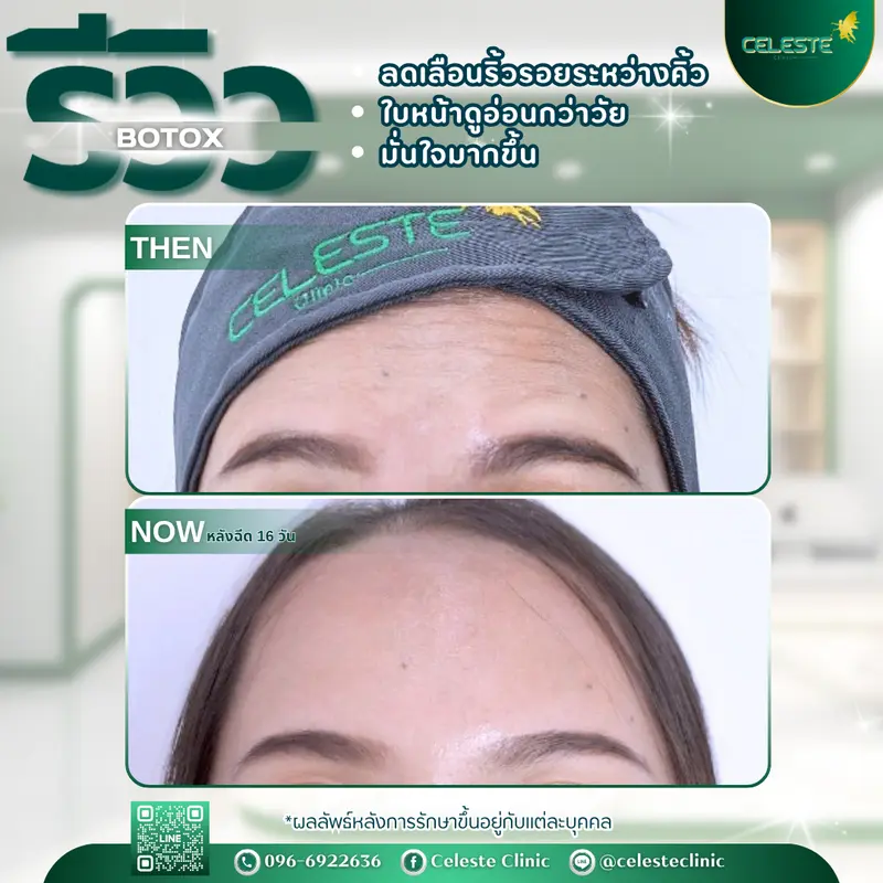รีวิวโบท็อค เชียงใหม่