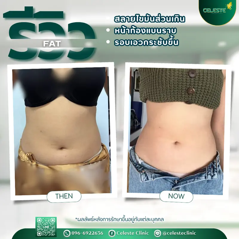 รีวิว FAT