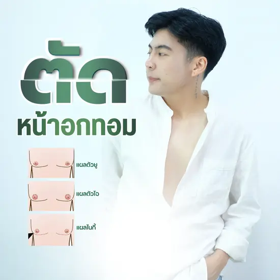 ตัดหน้าอกทอม/ทรานส์เชียงใหม่ โดยแพทย์ผู้เชี่ยวชาญ Celeste Clinic