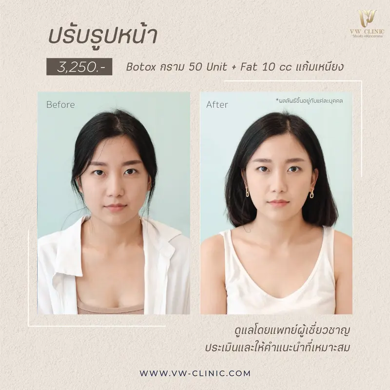 รูปภาพรีวิวปรับรูปหน้า