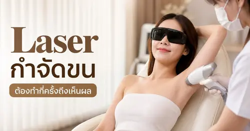Laser กำจัดขนเชียงราย ต้องทำกี่ครั้งถึงเห็นผล